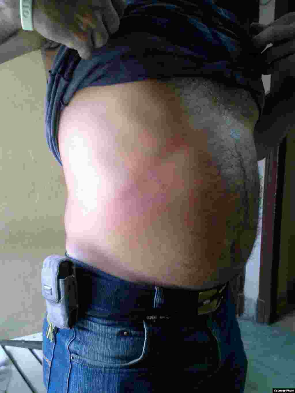 Hablemos Press divulga imagenes de activistas victimas de actos de repudio y agresiones